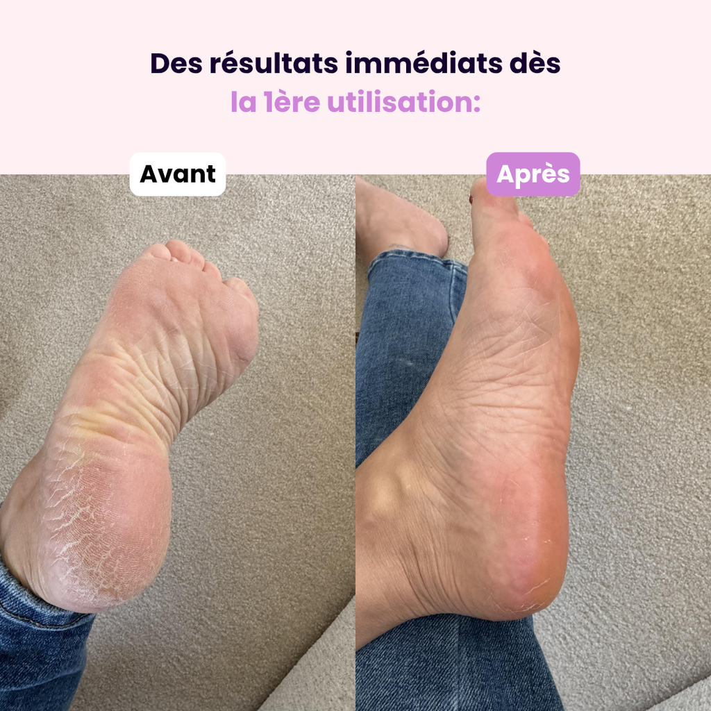 Lime en Cristal – Pieds & Talons Parfaits