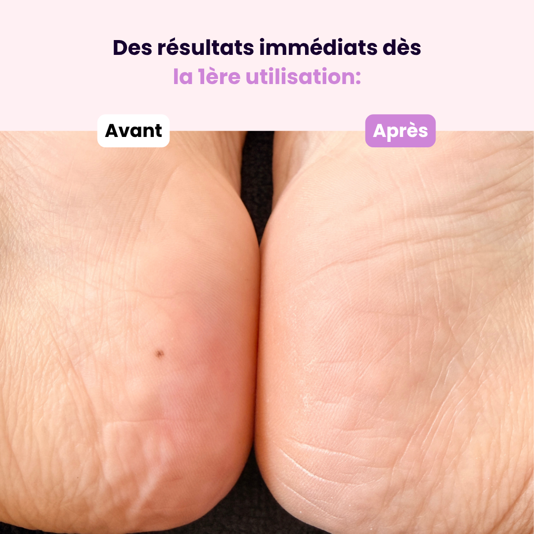 Lime en Cristal – Pieds & Talons Parfaits