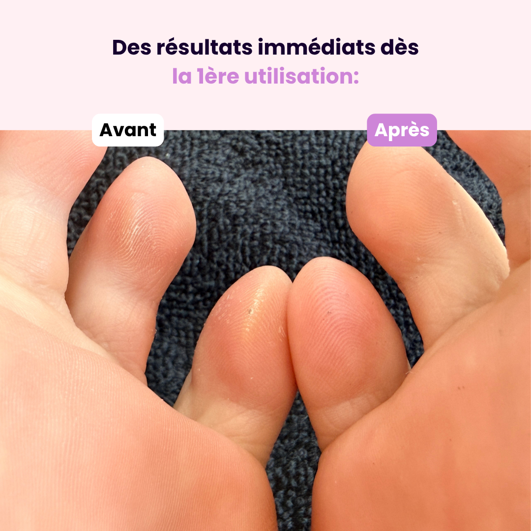 Lime en Cristal – Pieds & Talons Parfaits