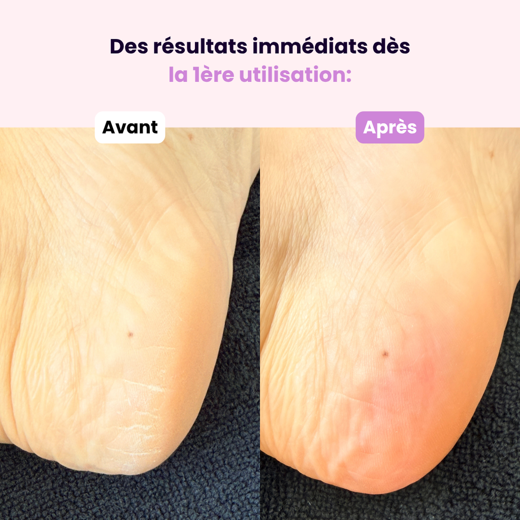 Lime en Cristal – Pieds & Talons Parfaits